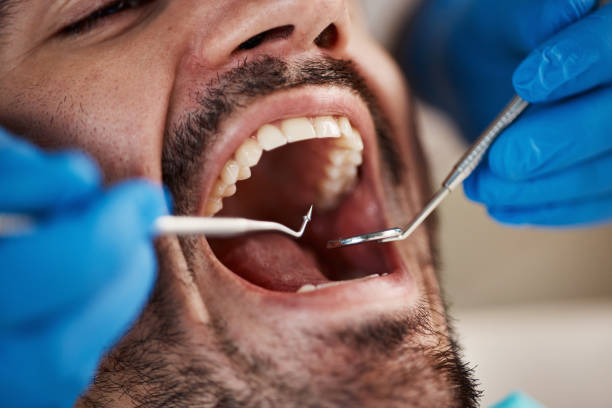  Fourche Crossing, LA Emergency Dentist Pros