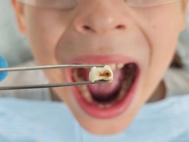 Best Emergency Broken Tooth Repair in Fourche Crossing, LA